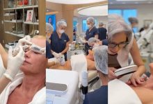 Rainha dos Baixinhos faz 80 procedimentos dermatológicos em São Paulo